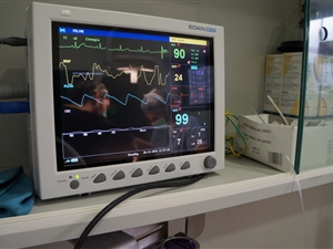 Monitor anestésico